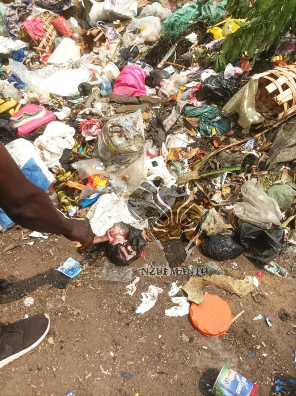 Douala – Bepanda : Un Nouveau-né Retrouvé dans une Poubelle, Enquête en Cours